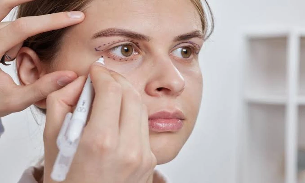 10 Essential Things to Know Before and After Under Eye Bag Surgery